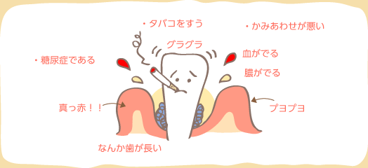 ・タバコをすう・糖尿症である・かみあわせが悪い・歯がグラグラ・歯茎が真っ赤、プヨプヨ・歯茎から血や膿がでる・なんか歯が長い